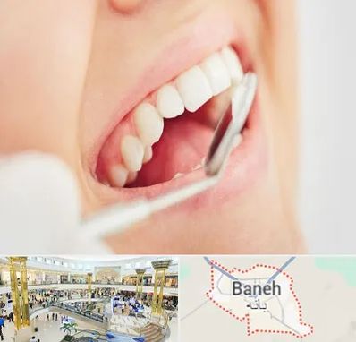 اصلاح طرح لبخند در بانه