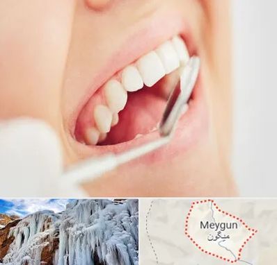 اصلاح طرح لبخند در میگون