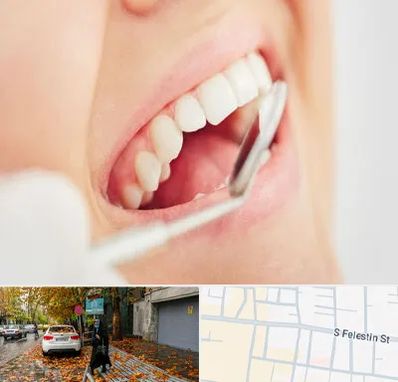اصلاح طرح لبخند در خیابان فلسطین