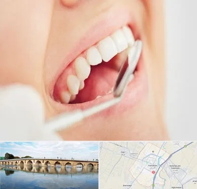 اصلاح طرح لبخند در فلاورجان