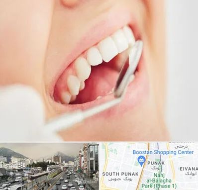 اصلاح طرح لبخند در پونک 