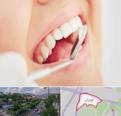 اصلاح طرح لبخند در لویزان