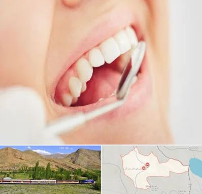 اصلاح طرح لبخند در خاش