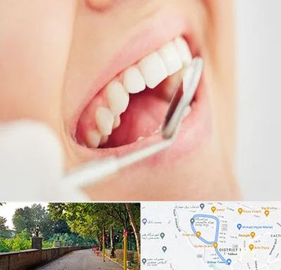 اصلاح طرح لبخند در فلکه گاز رشت