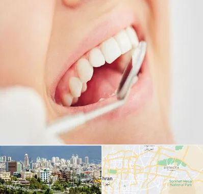 اصلاح طرح لبخند در شرق تهران 