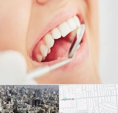 اصلاح طرح لبخند در جیحون