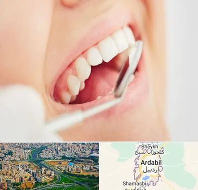 اصلاح طرح لبخند در اردبیل