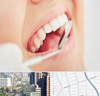 اصلاح طرح لبخند در خیابان بهشتی