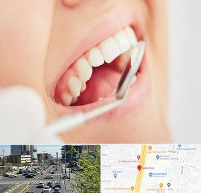 اصلاح طرح لبخند در ستاری