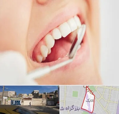 اصلاح طرح لبخند در اتابک