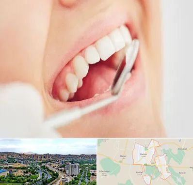 اصلاح طرح لبخند در شهریار