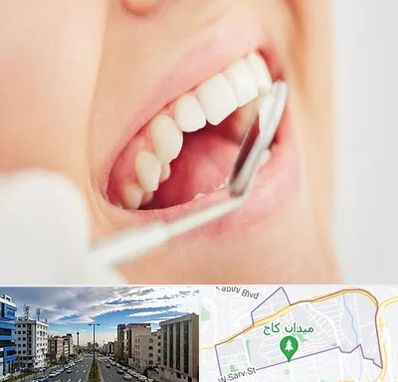 اصلاح طرح لبخند در سعادت آباد 