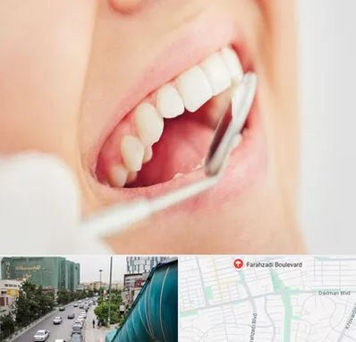 اصلاح طرح لبخند در بلوار فرحزادی