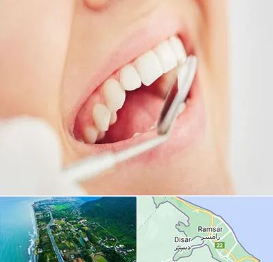 اصلاح طرح لبخند در رامسر