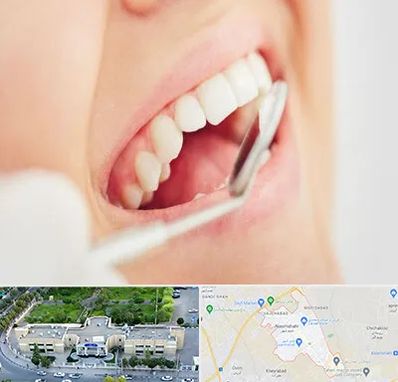 اصلاح طرح لبخند در نسیم شهر