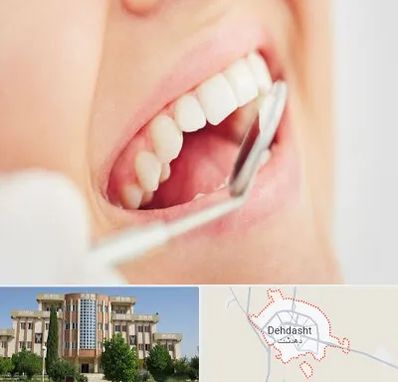 اصلاح طرح لبخند در دهدشت