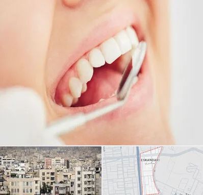 اصلاح طرح لبخند در اسکندری