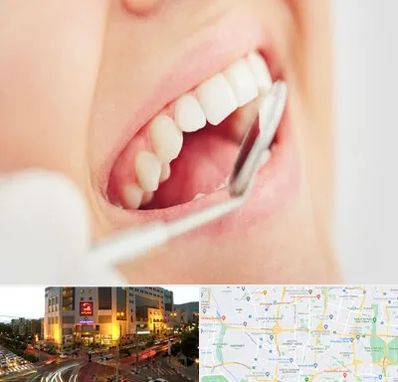 اصلاح طرح لبخند در جنت آباد تهران 