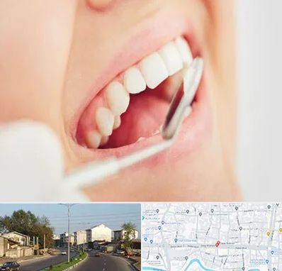 اصلاح طرح لبخند در ضیابری رشت