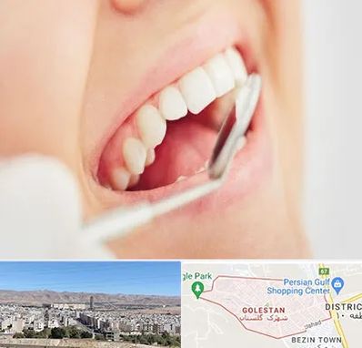 اصلاح طرح لبخند در شهرک گلستان شیراز