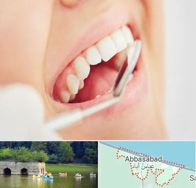اصلاح طرح لبخند در عباس آباد