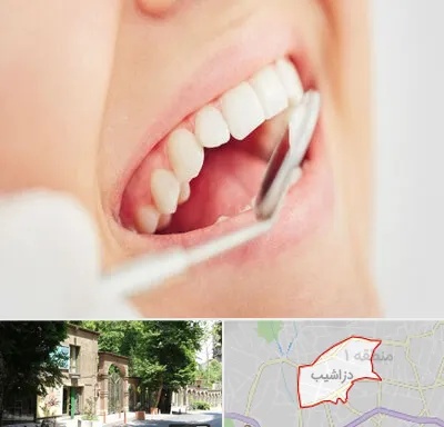 اصلاح طرح لبخند در دزاشیب