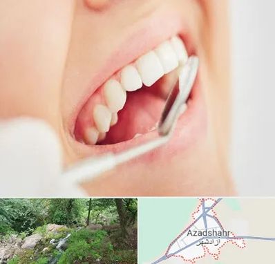 اصلاح طرح لبخند در آزادشهر