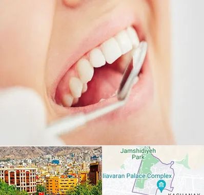 اصلاح طرح لبخند در نیاوران 