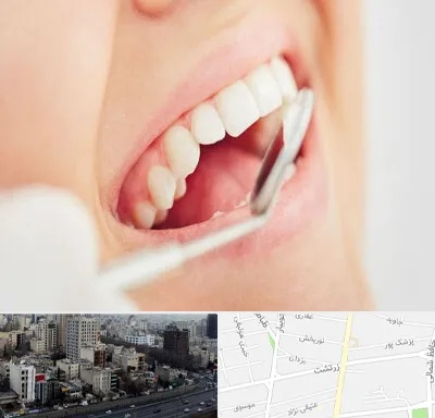 اصلاح طرح لبخند در زرتشت