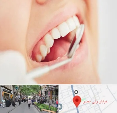 اصلاح طرح لبخند در ولیعصر شهریار
