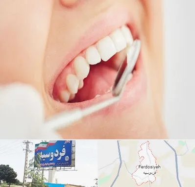 اصلاح طرح لبخند در فردوسیه شهریار