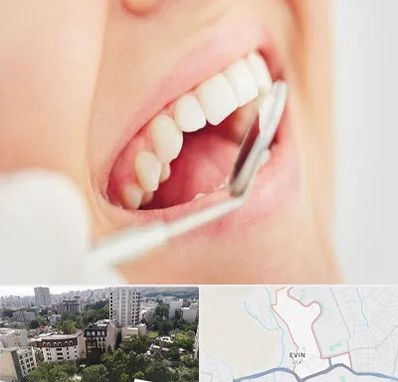 اصلاح طرح لبخند در اوین