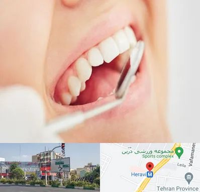 اصلاح طرح لبخند در هروی 