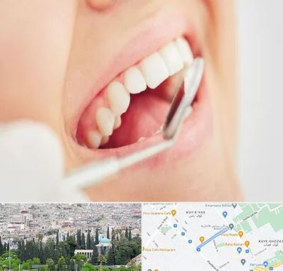 اصلاح طرح لبخند در محلاتی شیراز