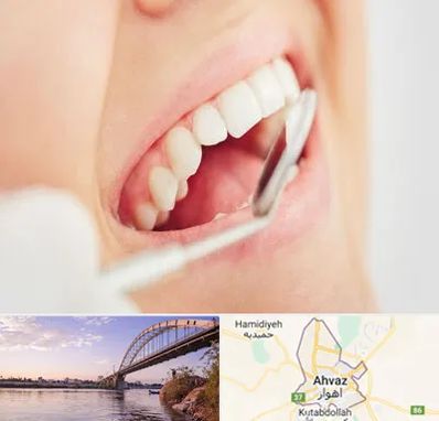 اصلاح طرح لبخند در اهواز