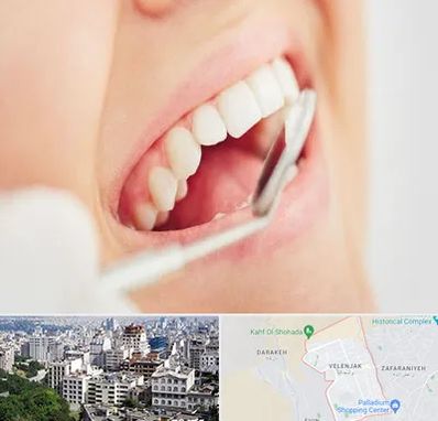 اصلاح طرح لبخند در ولنجک 