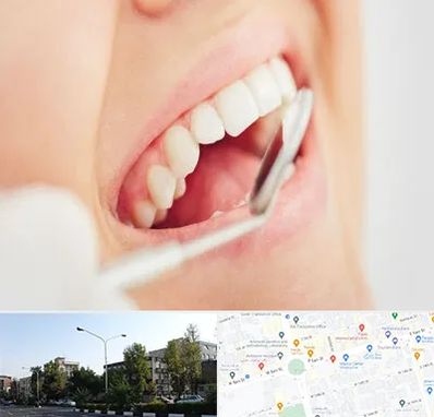 اصلاح طرح لبخند در میدان کاج