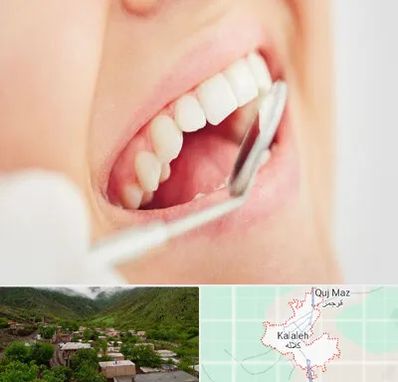 اصلاح طرح لبخند در کلاله