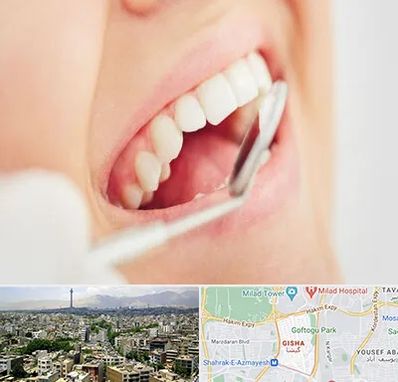 اصلاح طرح لبخند در گیشا 