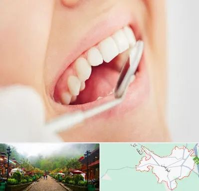 اصلاح طرح لبخند در فومن