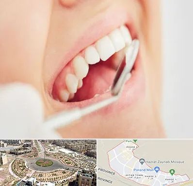 اصلاح طرح لبخند در پرند