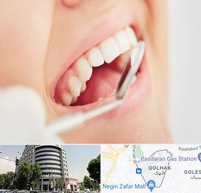 اصلاح طرح لبخند در قلهک 