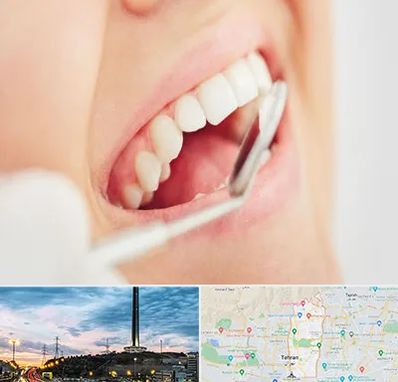 اصلاح طرح لبخند در منطقه 2 تهران