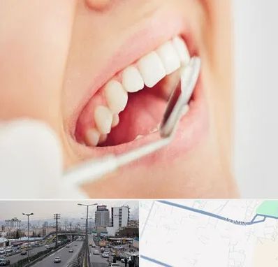 اصلاح طرح لبخند در بلوار ارتش