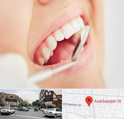 اصلاح طرح لبخند در خیابان آذربایجان