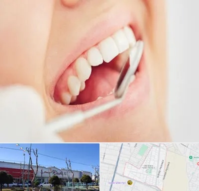 اصلاح طرح لبخند در فاز دو اندیشه