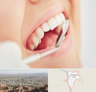 اصلاح طرح لبخند در اسفراین