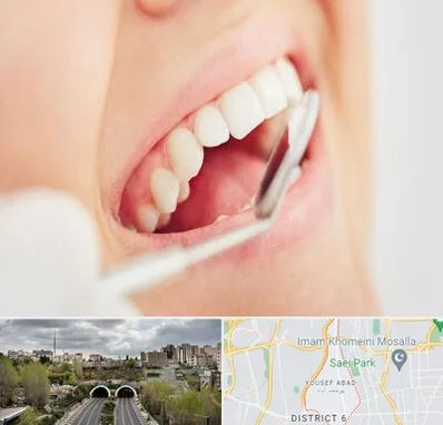 اصلاح طرح لبخند در یوسف آباد 