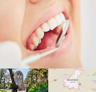 اصلاح طرح لبخند در نیشابور