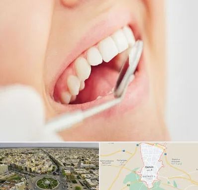 اصلاح طرح لبخند در قزوین